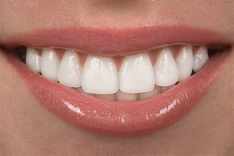 How Magic Teeth Braces Can Help You Achieve the Smile You Desire